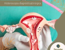 Histeroscopia-diagnostica-cirurgica-Clinica-Fecundar-FIV-Sinop-MT-Dra-Daianni-Stadtler