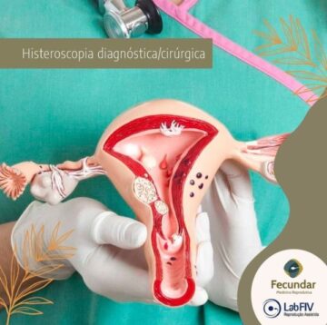 Histeroscopia-diagnostica-cirurgica-Clinica-Fecundar-FIV-Sinop-MT-Dra-Daianni-Stadtler